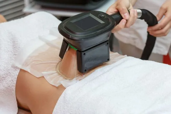 Image of person having fat freezing treatment to help weight gain Calton
