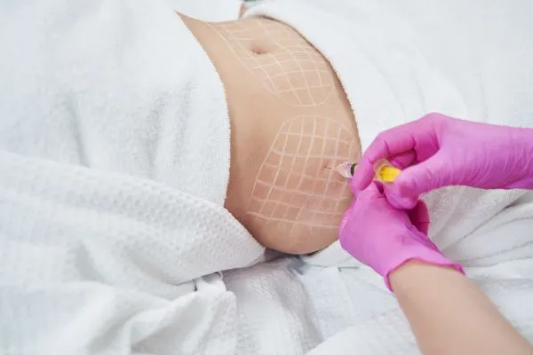 image of fat dissolving injections on love handles to help combat weight gain Calton